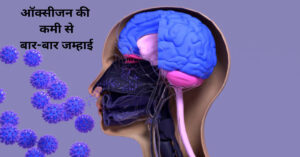 ऑक्सीजन की कमी से बार-बार जम्हाई का कारण 